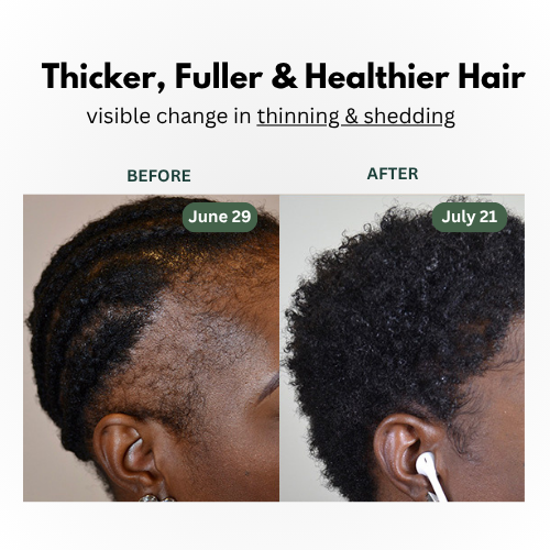 100% Pure Batana Oil - Natural Hair Growth Oil