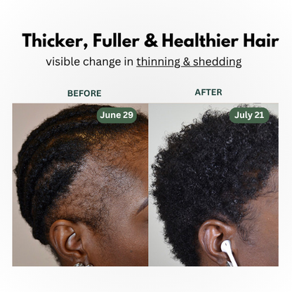 100% Pure Batana Oil - Natural Hair Growth Oil